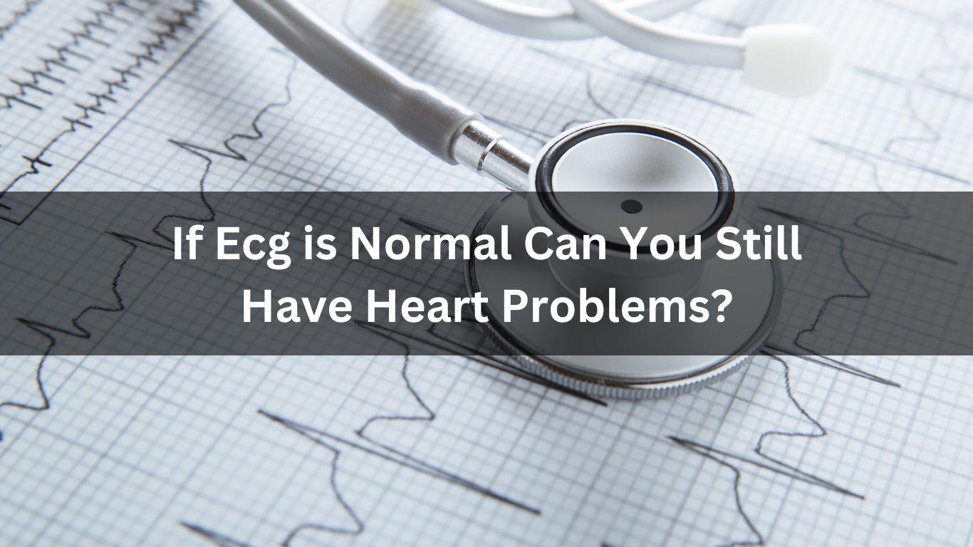 If ECG is Normal Can You Still Have Heart Problems?