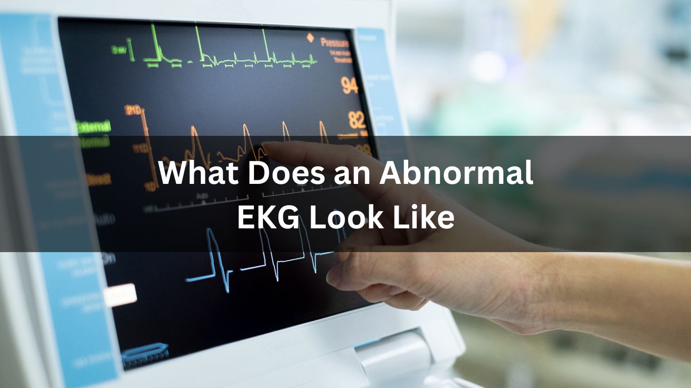 What Does an Abnormal EKG Look Like
